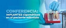 Conferencia: Implantes cigom&aacute;ticos en el paciente ed&eacute;ntulo
