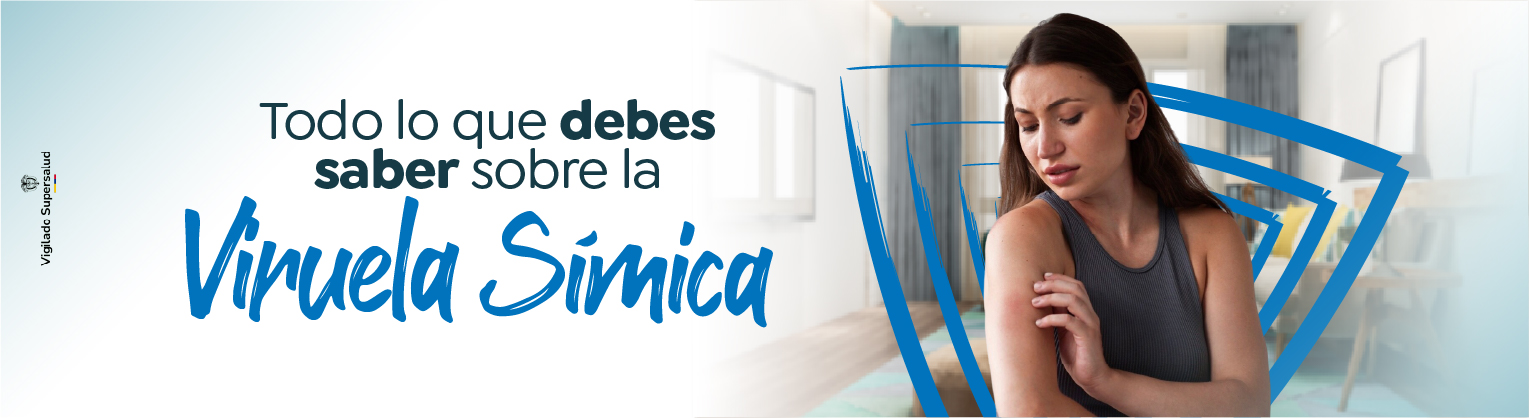 Todo lo que debes saber sobre la Viruela Símica Todo lo que debes saber sobre la Viruela Símica